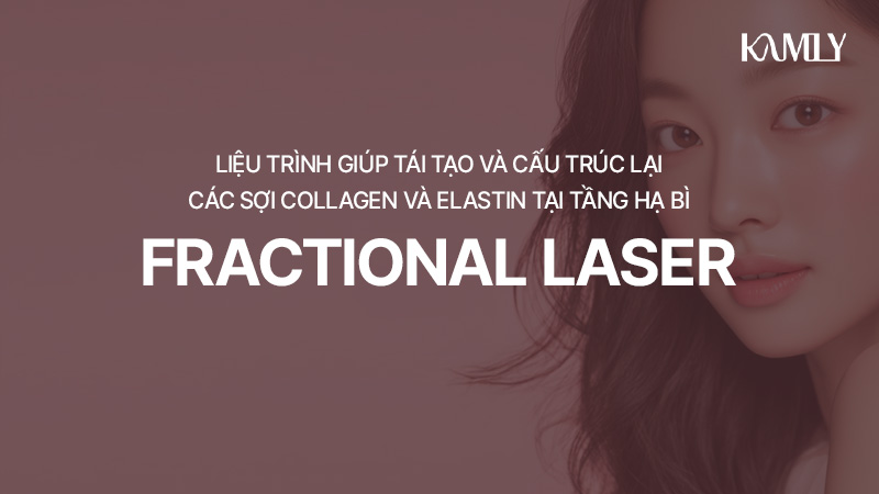 product_308
