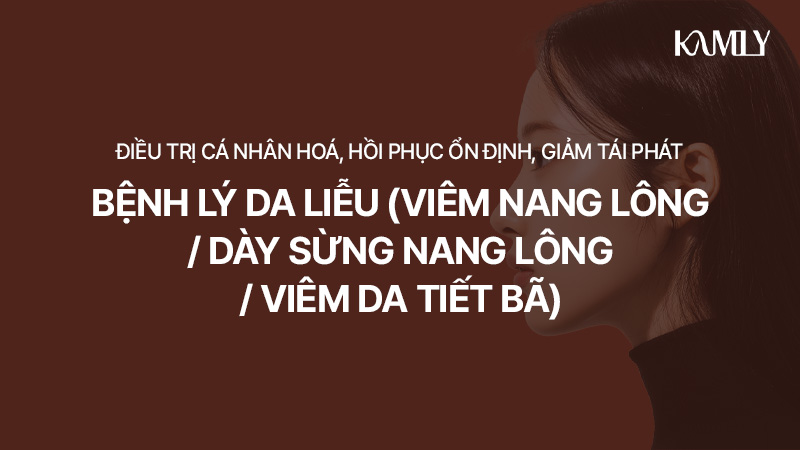 product_194